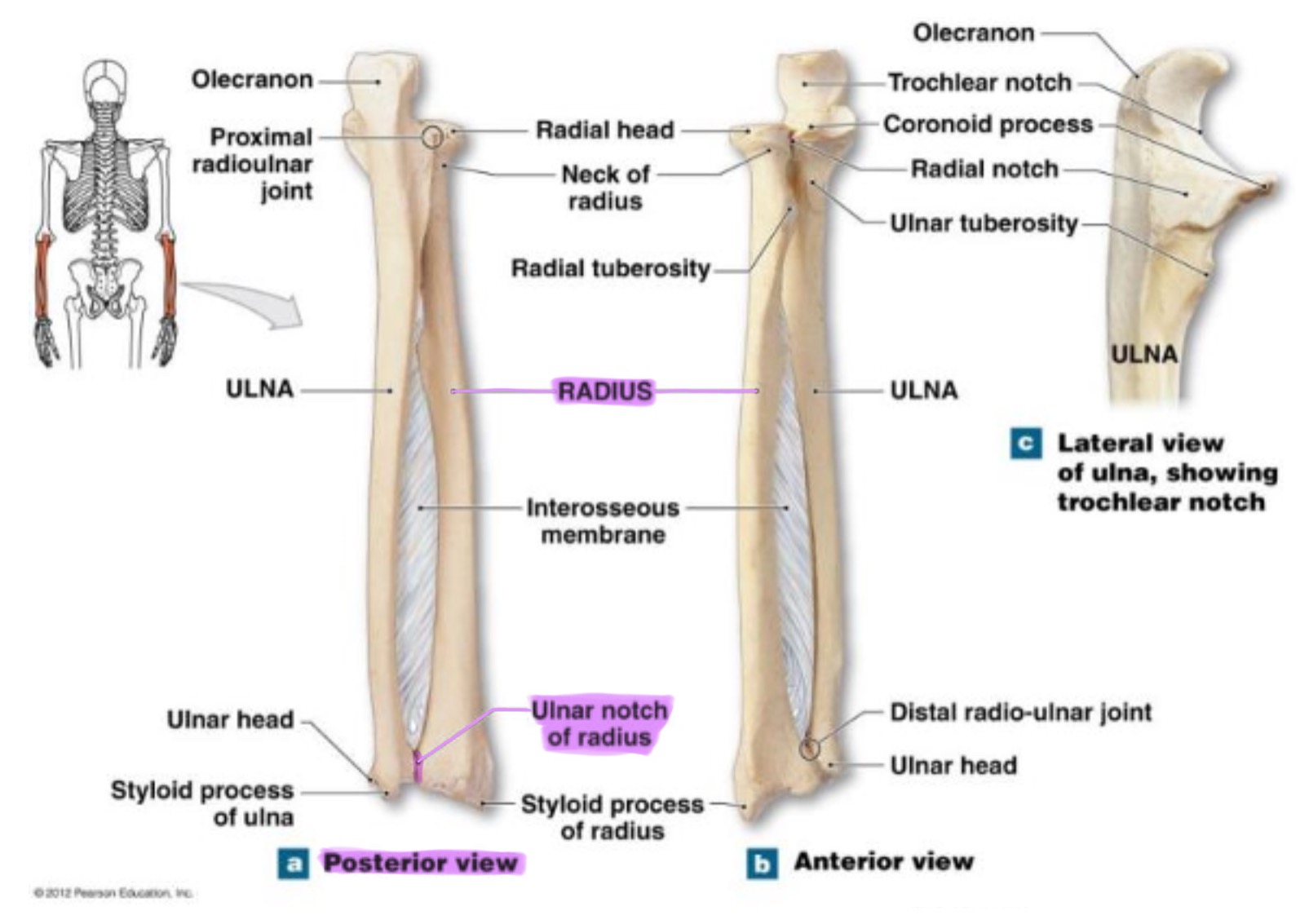 <p>small depression on distal medial side; articulates w/ head of ulna to form the distal radioulnar joint</p>