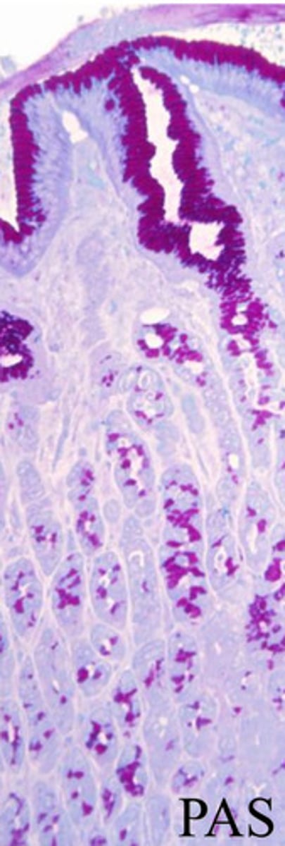 <p>mucous neck cells</p>