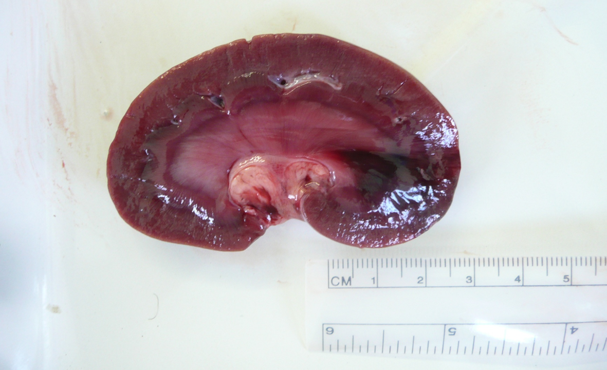 <p>What organ is this? Give a morphological description, morphological diagnosis, and possible etiology and pathogenesis</p>