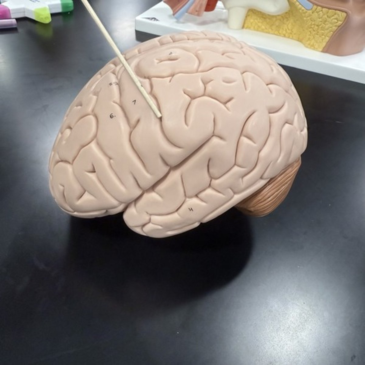 <p>What is this lobe of the cerebrum?</p>