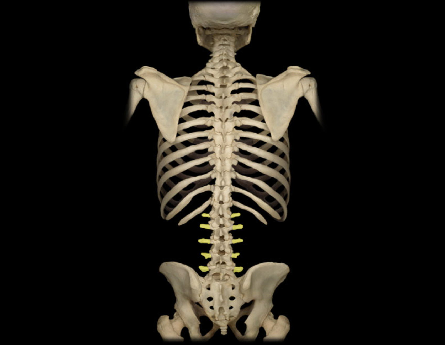 <p>Transverse process of lumbar vertebra</p>
