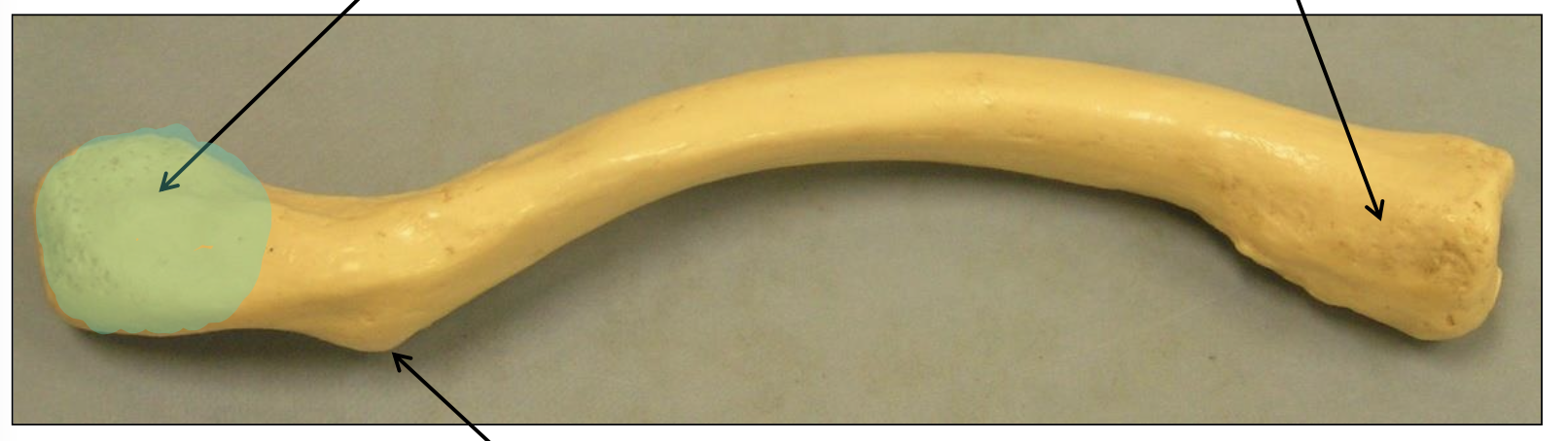 <p>What end of the clavicle is highlighted in this image?</p>