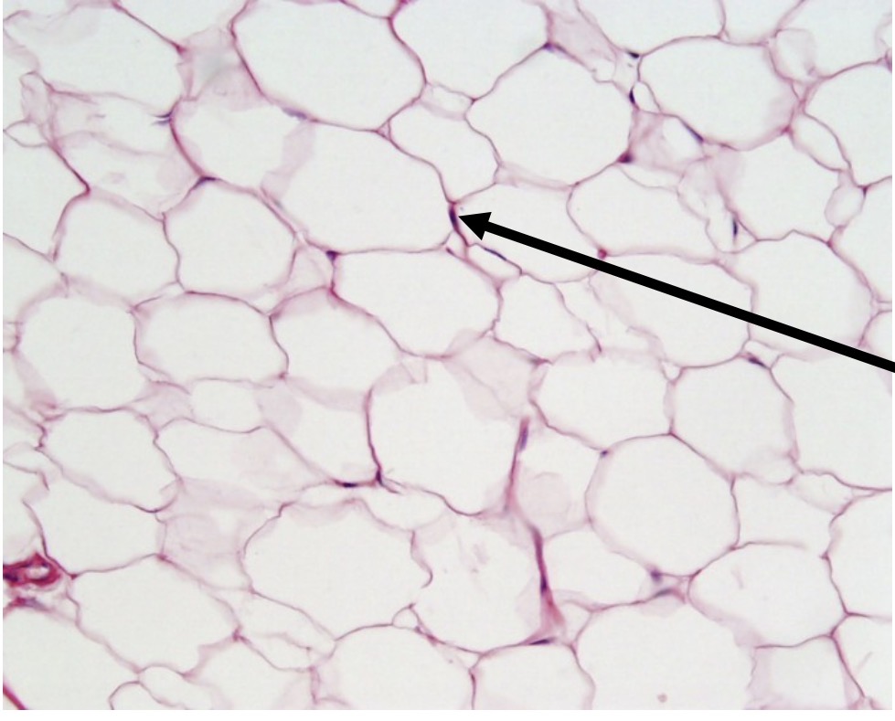 <p>Identify the type of tissue and the<br>structure at the arrow</p>