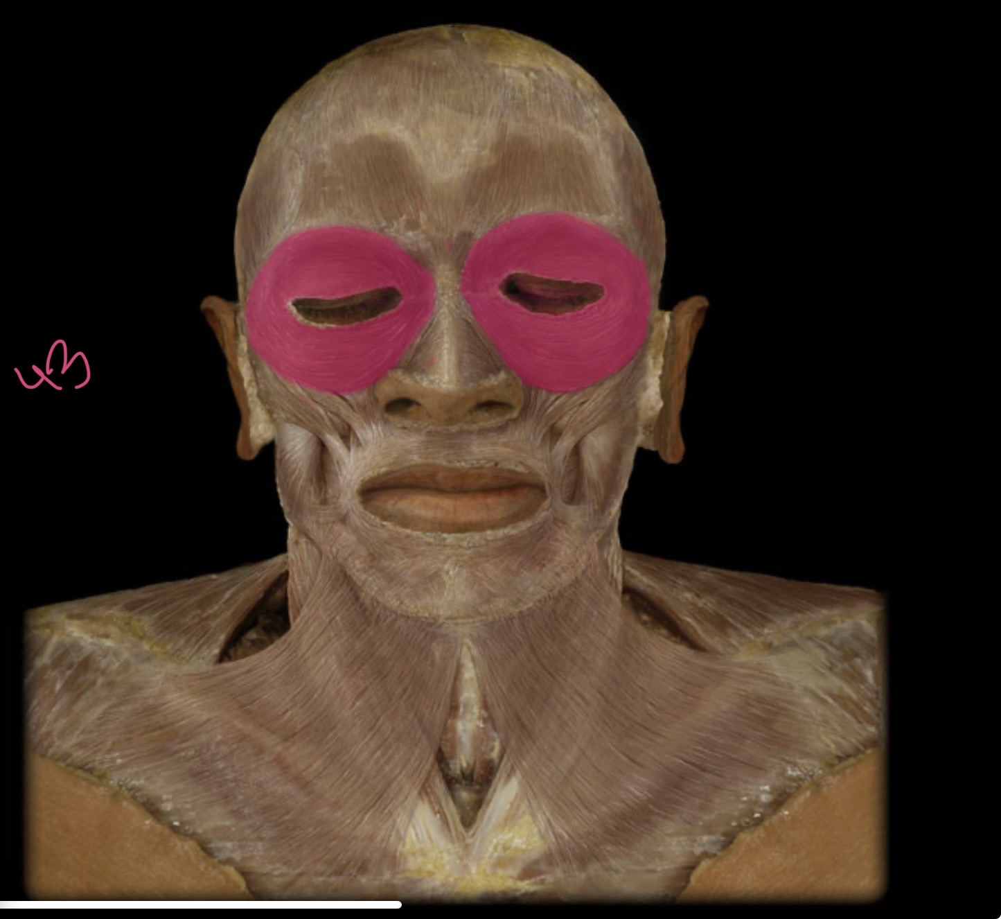 <p>Orbicularis oculi</p>
