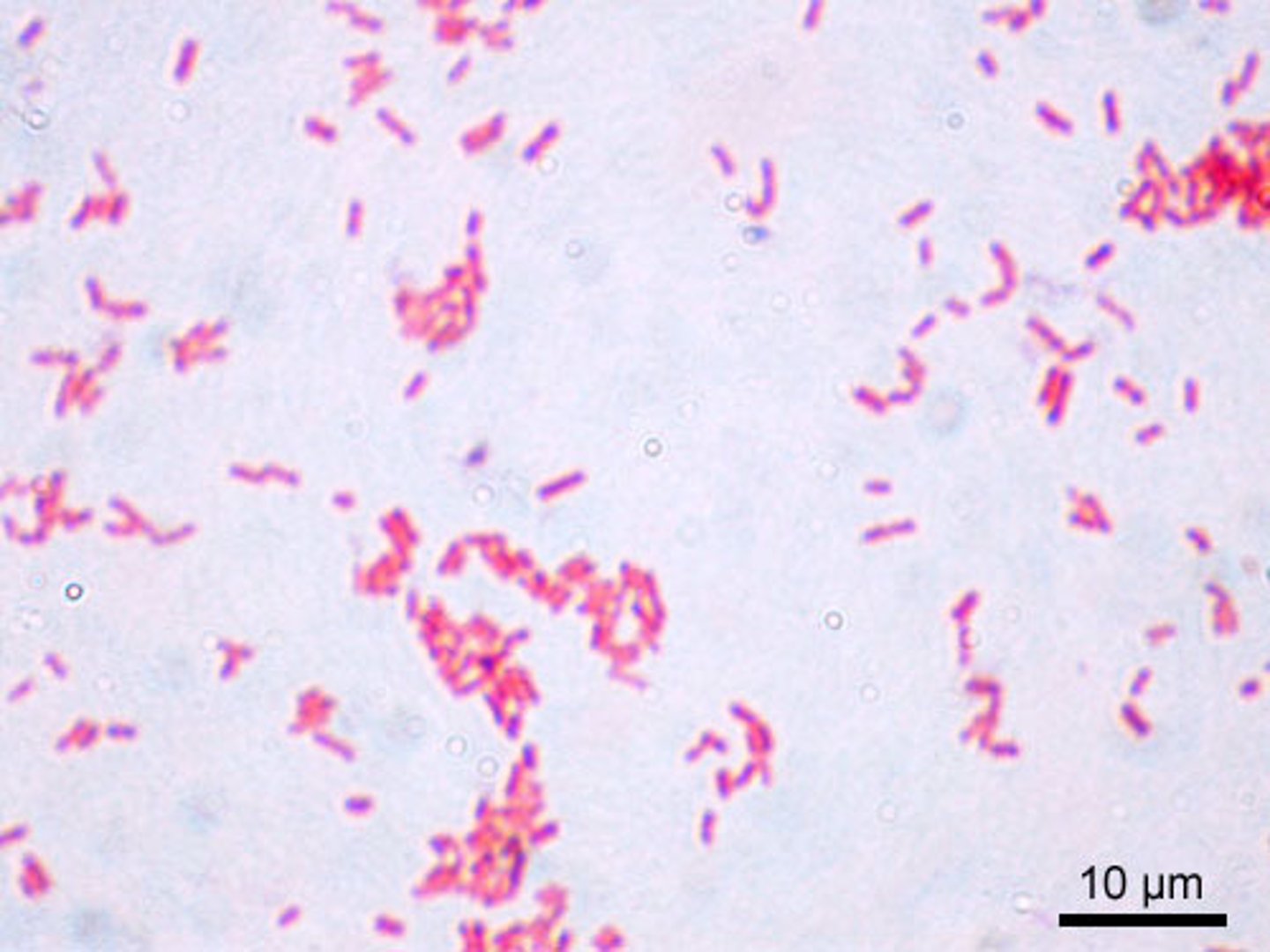 <p>Pink -- THIN cell wall</p>