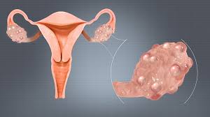 <p>What gland is this?</p>