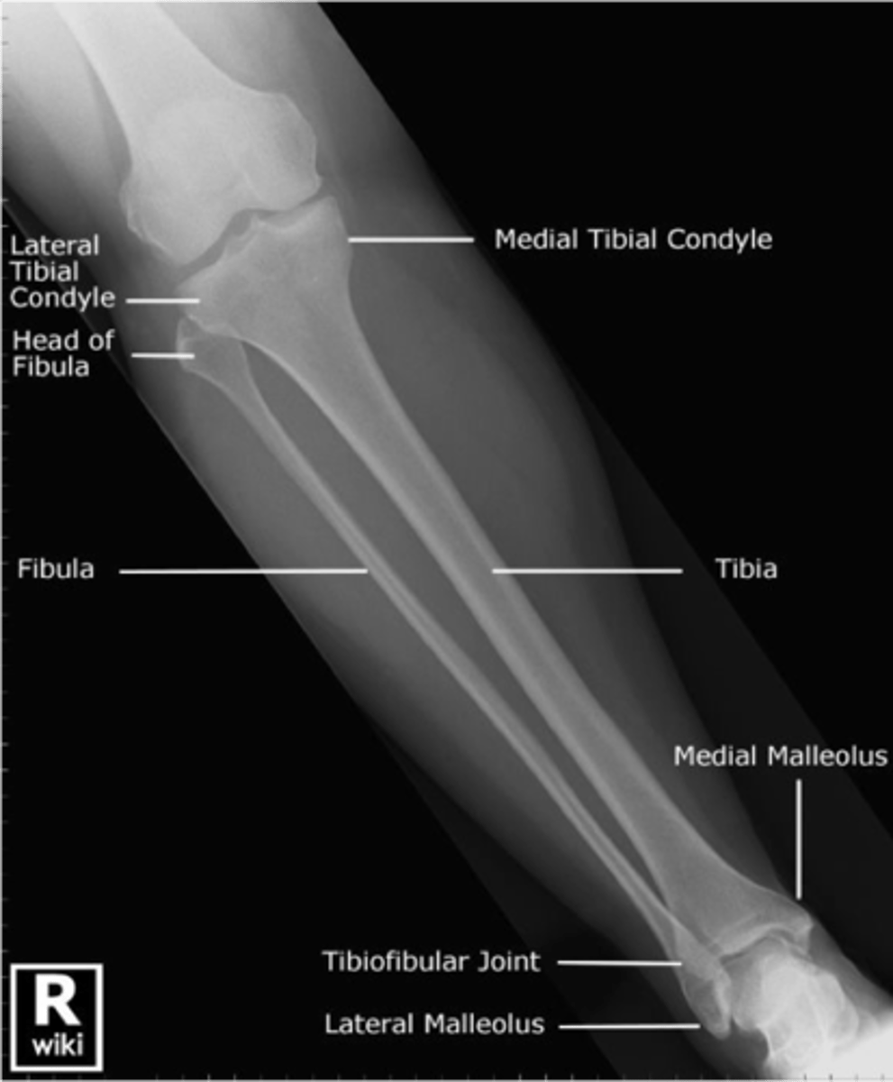 <p>- to include the entire length of the tibia and fibula bones and lateral soft tissue borders. The knee and ankle joint must also be included.</p>