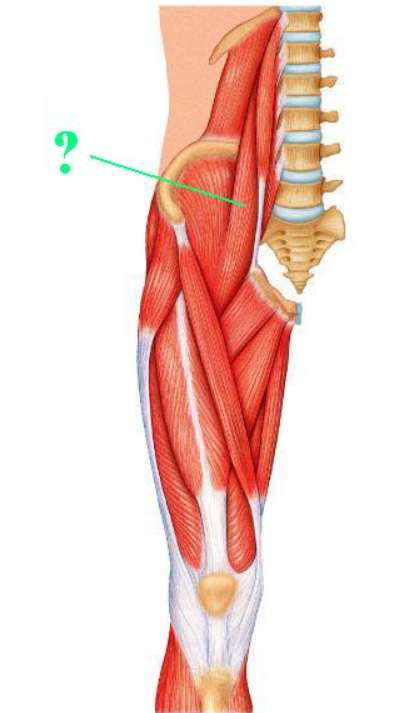<p><span>Identify the indicated muscle.</span></p>