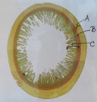 <p>Tela submucosa</p>