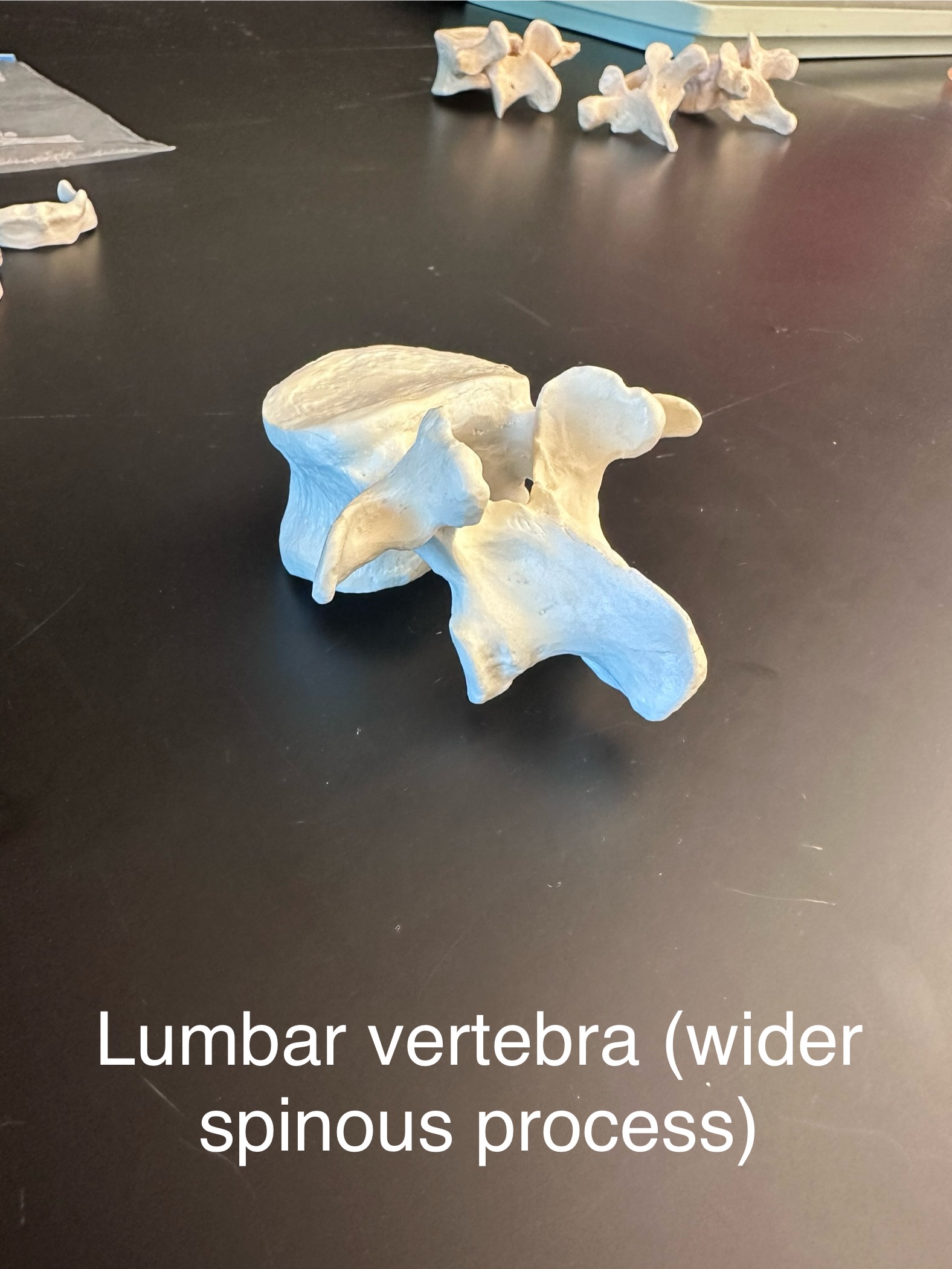 <p>Lumbar vertebra: you can tell by knowing the spinous process is wider</p>