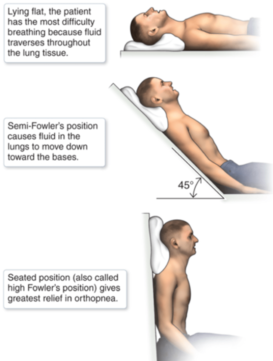 <p>difficulty breathing when supine</p>
