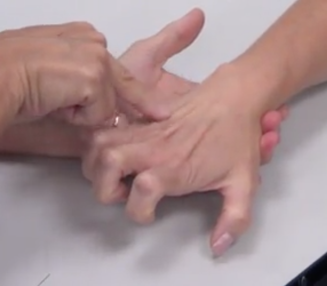 -Same position as grade 3,4,5 
-Extensor digitorum (can see tendons by doing motion or palpate muscle belly by lateral epicondyle)