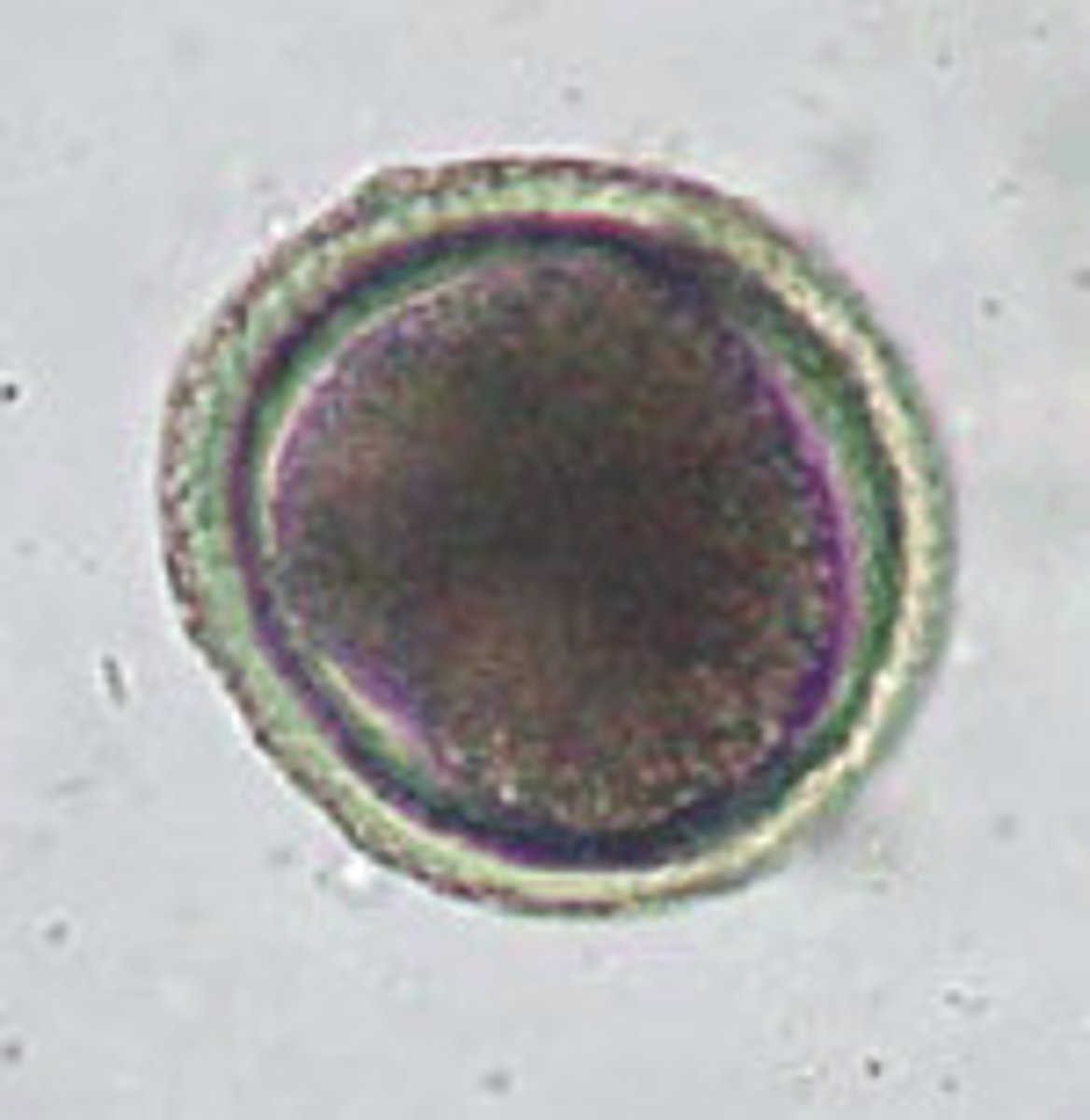 <p>canine roundworm</p>