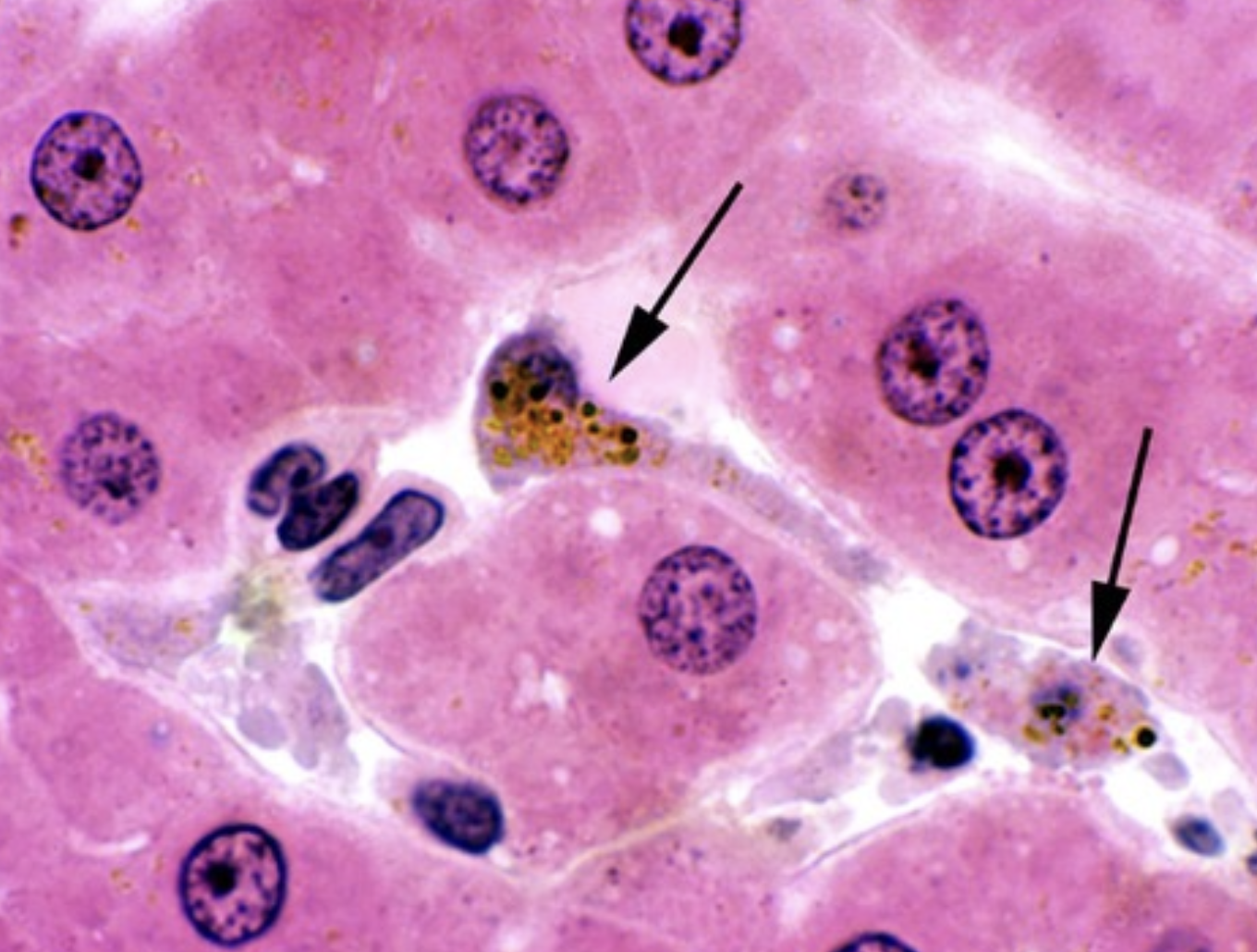 <p>What are the arrows pointing to?</p>