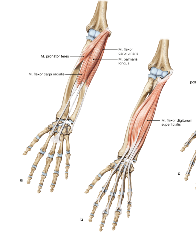 <ul><li><p>m. palmaris longus</p></li><li><p>m. flexor carpi ulnaris</p></li><li><p>m. flexor carpi radialis</p></li><li><p>m. flexor digitorum superficialis</p></li><li><p>m. pronator teres</p></li></ul><p></p>