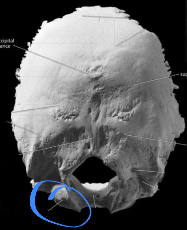 <p>Located in the occipital bone of the cranium </p>