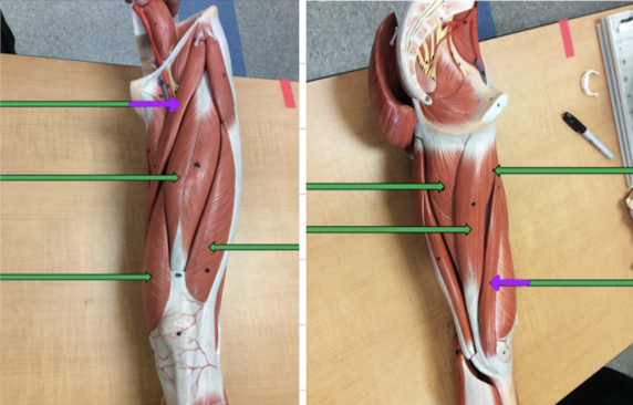 <p>Identify this muscle?</p>