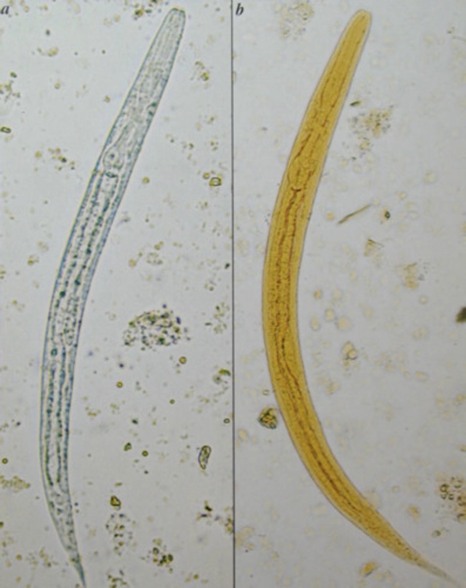 <p>-gut</p><p>-the eggs can develop into infective stage NEEDING SOIL!!(from using night soil for fertilization or pica)</p><p>-lung migration stage!!</p><p>-SKIN PENETRATION!</p><p>-ONGOING AUTOINFECTION!</p><p>-threadworm!!</p><p>-larvae penetrate skin and then go to gut</p><p>-we don't see egg in stool, only ever larvae!!!!! larvae in stool, always thing strongyloides</p><p>-THEREFORE ALSO CAUSES GROUND ITCH BC THROUGH SKIN!</p><p>SKIN: itchy dermatitis from penetration</p><p>LUNG: loeffler's syndrome</p><p>Intestine: burrow and damage mucosa leading to bloody diarrhea and chronic cholitis</p><p>-infection can go on for 10-20 years; hyperinfection in immunocompromised is very dangerous!</p><p>-since we need up to 7 exams to see larvae, we do the agar culture method instead</p><p>EGG:</p><p>WORM:</p><p>*only larvae is seen, never the egg</p><p>*but can take up to 7 exams soooo</p><p>-agar culture method!</p><p>*put stool on agar and the migrating larvae out of the stool will move the bacteria too and you'll see tracks</p>