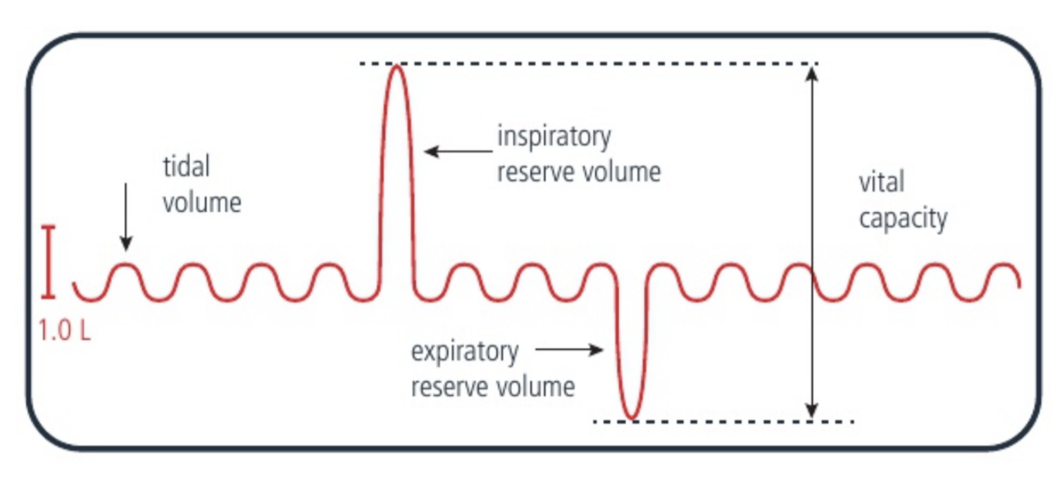 <p>A device used to measure lung volume</p><p>Creates a graph for lung volume vs time</p>