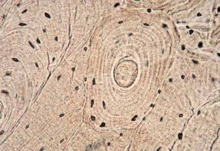 <p><span>Think of it as a brick wall – super dense and strong on the outside of the bone, made of tiny repeating bricks (osteons).</span></p>