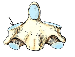 <p><span>The part identified by the arrow on the vertebra in this figure is the:</span></p>
