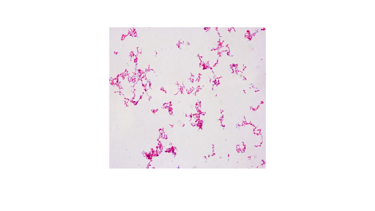 <p><span>looking at the micrograph, does the bacteria Mycobacterium smegmatis produce the waxy material in its cell wall</span></p>