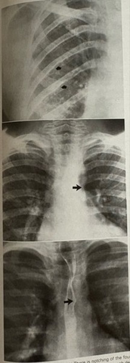 <p>what pathology is present?</p>