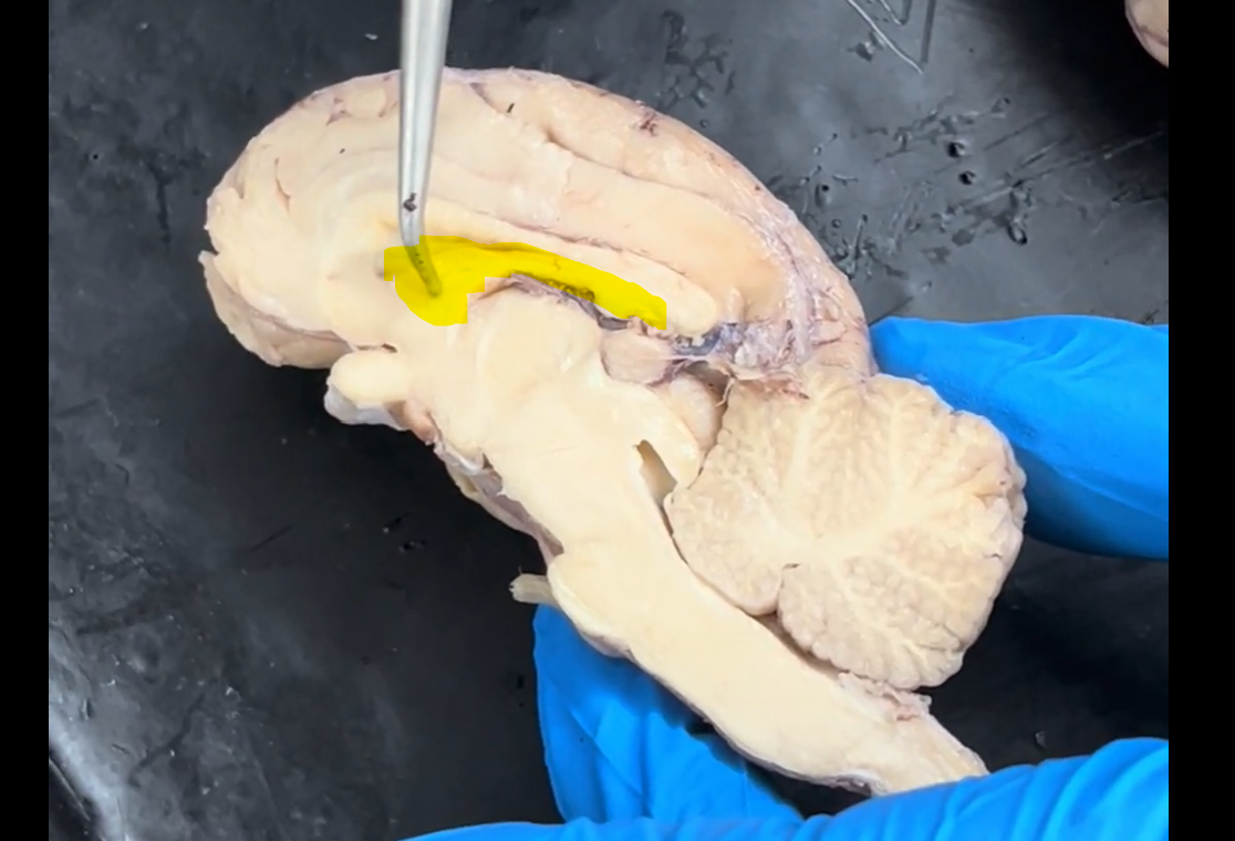 <p>Name the part of the brain highlighted in yellow.</p>