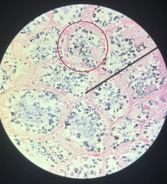 <p>What is the term used to describe the central, fluid-filled space within this structure where the process of spermatogenesis occurs in the male reproductive system?</p>