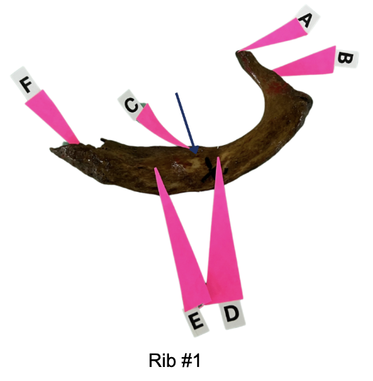 <p>Identify the scalene tubercle for insertion of anterior scaleneus (check insertion site for middle scaleneus)</p>
