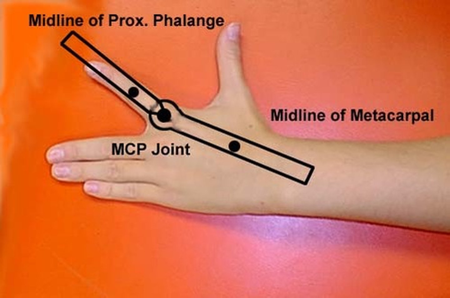 <p>fulcrum: dorsal MCP joint<br>proximal: dorsal midline of metacarpal<br>distal: dorsal midline of proximal phalanx<br><br>* medial/ulnar side of hand resting on table<br>* normal value = 25</p>
