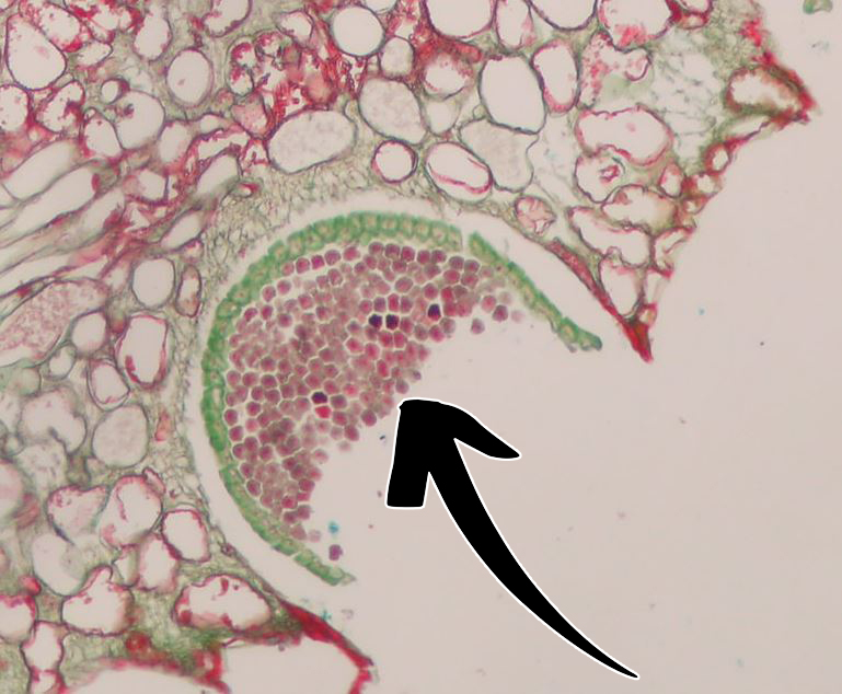 <p>Puccinia graminis: Vad indikerar pilen på för struktur + spor?</p>