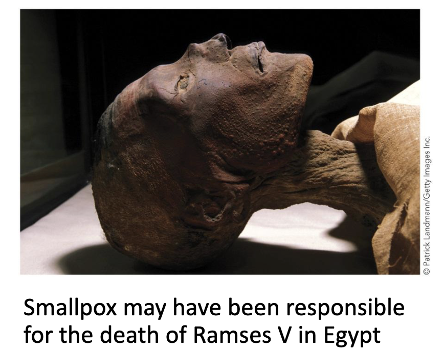 <ul><li><p>History of virology.</p></li><li><p>Viral diseases have plagued humans since before we even knew what they were (<strong><em>smallpox</em></strong> in Egypt).</p></li><li><p>It began as a science in late <strong><em>1800s</em></strong>, when infectious <strong><em>tobacco mosaic virus</em></strong> was isolated in a filtered, bacteria-free fluid by <strong><em>Ivanovski</em></strong>, then <strong><em>Beijerinck</em></strong>.</p></li></ul><p></p>