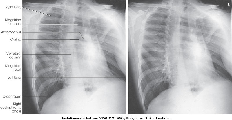 <p>What position is demonstrated?</p>