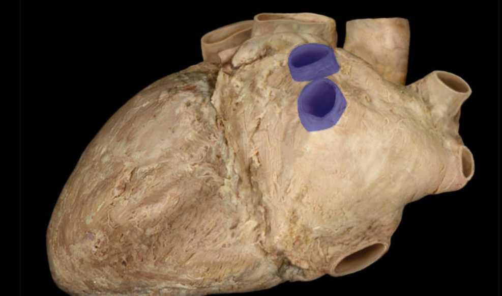 <p>Identify the structure </p>