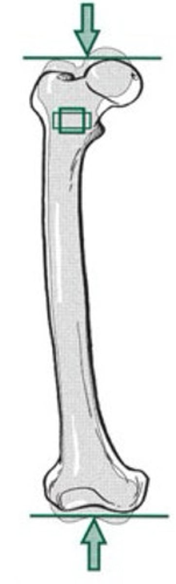 <p>pressing or squeezing force directed normal to a surface (normal = perpendicular to the longitudinal axis); causes widening and/or shortening</p>