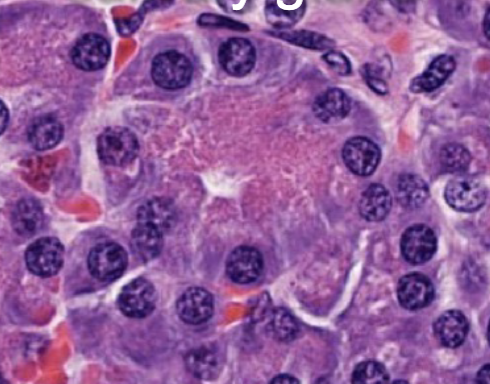 <p>what is this gland?</p>