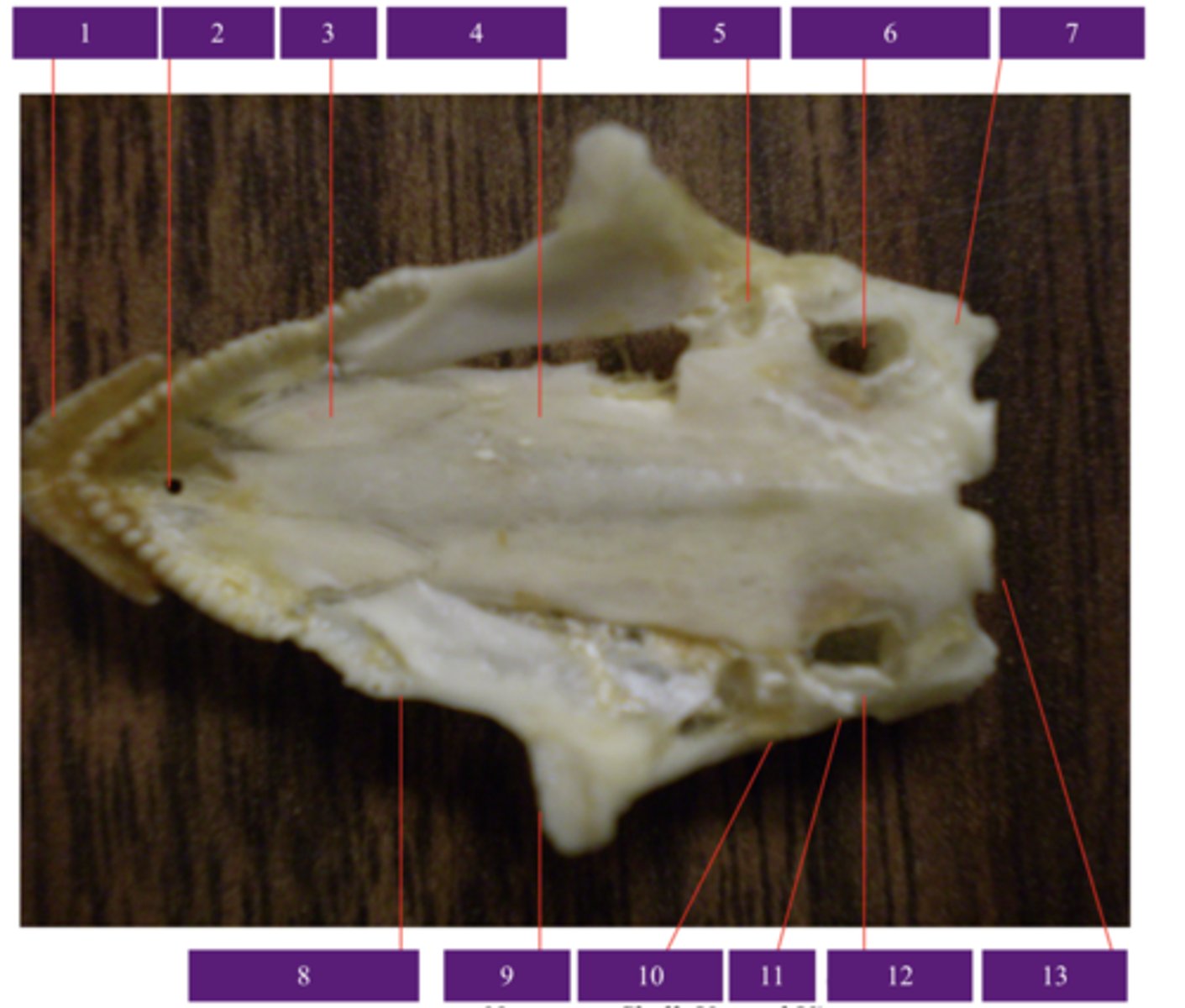 <p>What does number 13 point to?</p>