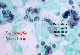 <ul><li><p>Distribution: southcentral, southeast and east Asia</p></li><li><p>Ecologic niche: soil and has been isolated from bamboo rats</p></li><li><p>Route of infection:</p><ul><li><p>inhalation of conidia</p></li><li><p>traumatic implantation</p><ul><li><p>eating bamboo rat</p></li></ul></li></ul></li><li><p>Clinical syndromes:</p><ul><li><p>disseminated skin infections (skin, soft tissue)</p></li><li><p>occurs primarily in immunocompromised people in Thailand and SE China (early indicator of HIV)</p></li><li><p>resembles histoplasmosis, cryptococcosis and tuberculosis</p></li></ul></li><li><p>Diagnosis:</p><ul><li><p>microscopic detection in tissue</p></li><li><p>morphology: elliptical fission yeast that are intracellular</p></li><li><p>no serological testing but under development</p></li><li><p>molecular assay</p></li></ul></li></ul><p></p>