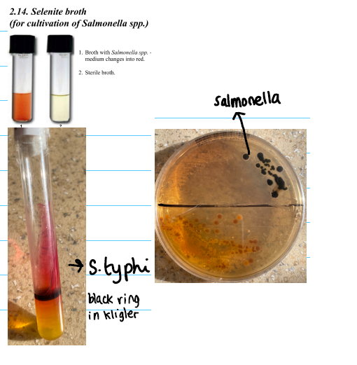 <p><strong>EMB agar /DCA agar</strong></p><ul><li><p>black spots on agar</p></li></ul><p><strong>Mac Conkey agar</strong></p><ul><li><p>negative -ve</p></li></ul><p><strong>Selenite broth:</strong></p><ul><li><p><u>Salmonella:</u> red</p></li><li><p><u>Sterile:</u> transparent</p></li></ul><p><strong>Kligler Agar:</strong></p><ul><li><p>Red</p></li><li><p>Black ring</p></li><li><p>Yellow</p></li></ul><p></p>