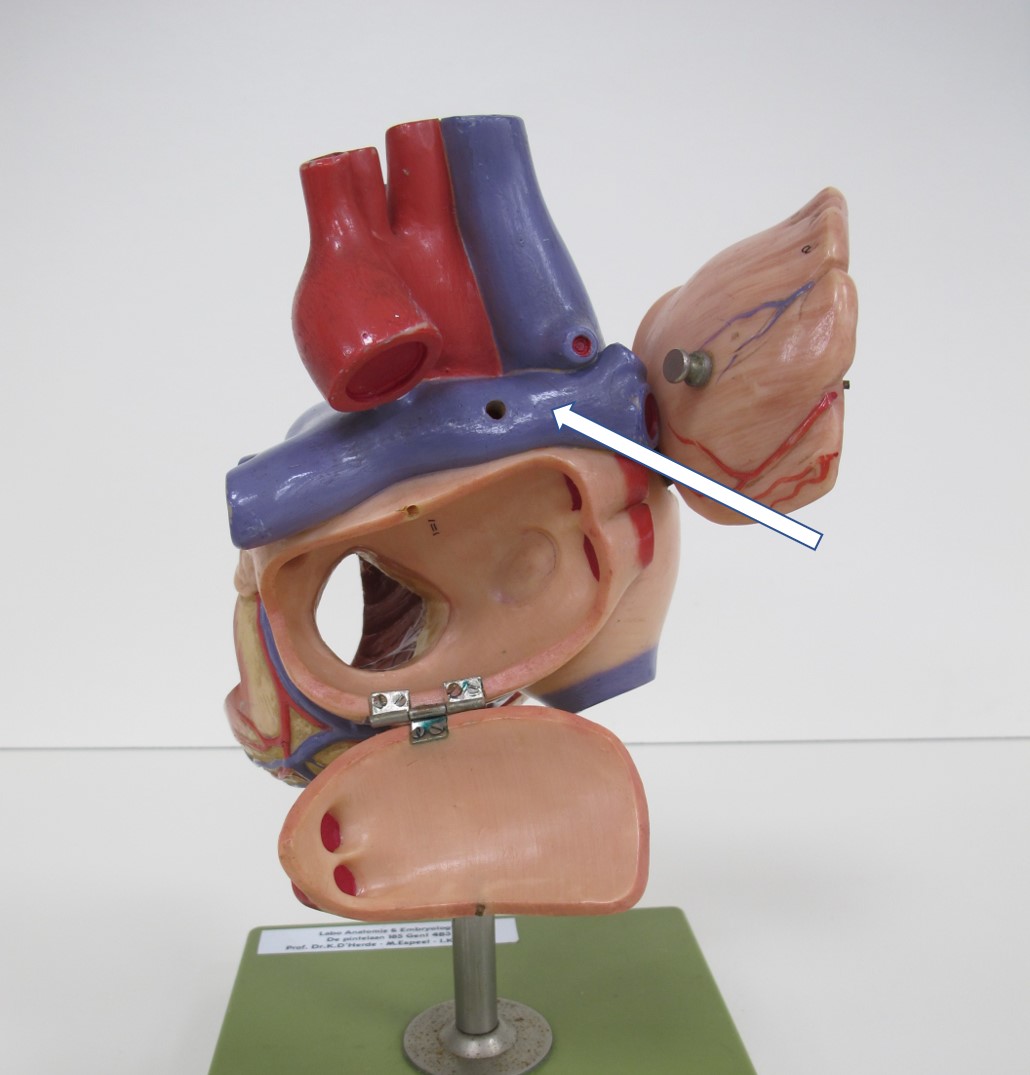 <p>bloedvat (dorsaal hartaanzicht met geopend linker atrium + specifiek)</p>