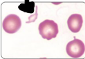 <p>Name the poikilocyte being pointed at. What causes it. </p>