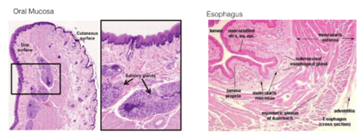 <p>Stratified squamous non-keratinized epithelium</p>