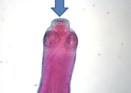 <p>Taenia solium </p>