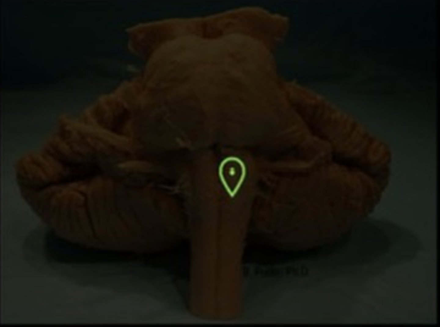 <p>What is the marked structure</p>