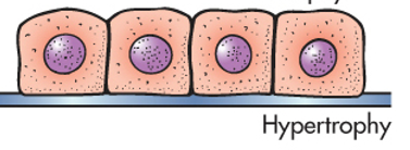 <p><span>Cell size getting bigger. Most of the time, it is the body trying to maintain homeostasis.</span></p><p><br></p>