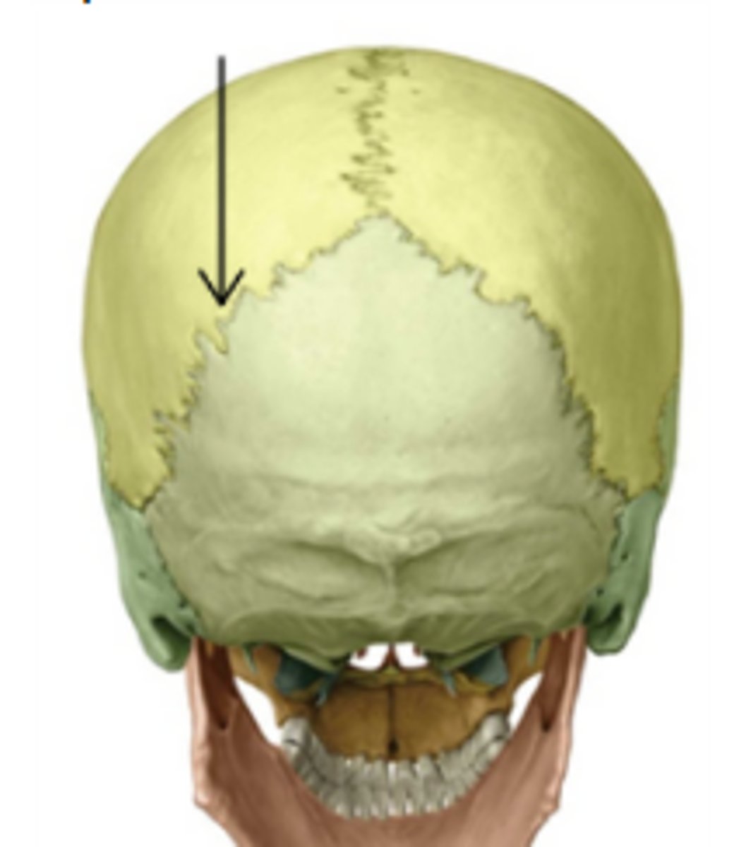 <p>occipital and parietal bones</p>
