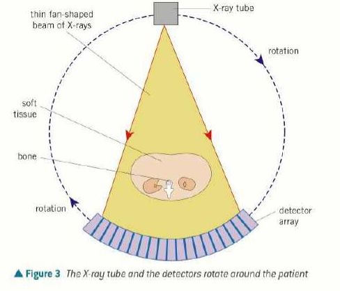 <ul><li><p>patient lies on back in a horizontal table that can slide in/out of gantry</p></li><li><p>gantry has x-ray tube on one side and an array of electronic x-ray detectors on opposite side (both rotate)</p></li><li><p>the x-ray tube produces a fan-shaped beam of x-rays 1-10mm thick</p></li><li><p>the detectors record the intensity of the transmitted x-rays and send electrical signals to a computer</p></li><li><p>every time 360 rotation, a two-d image or slice is acquired and the table moves 1cm through the ring, then the beam irradiates the next slice of the patients body</p></li><li><p>radiographer can view each 2D slice and make a 3D image</p></li></ul><p></p>