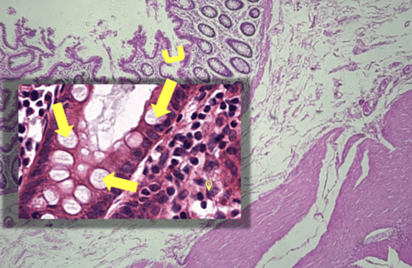 <p>name the cell & what it secretes</p>