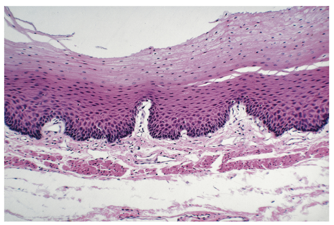 <p>Stratified squamous epithelium.</p>